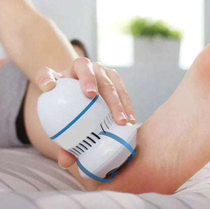 TrueAura™ Vacuum Callus Remover